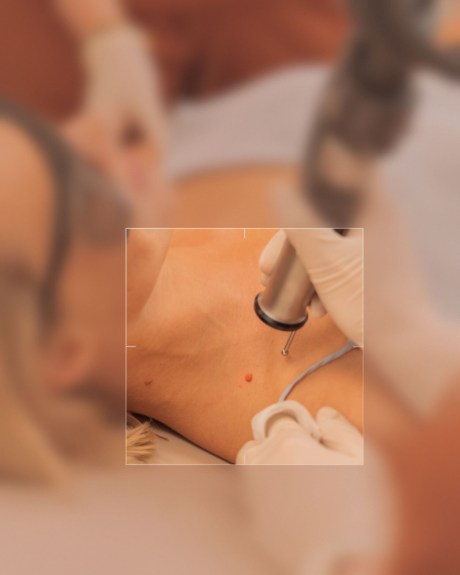 Frau mit Schutzbrille liegt entspannt, während eine Person mit Handschuhen einen Laser auf einen Hautpunkt am Hals richtet