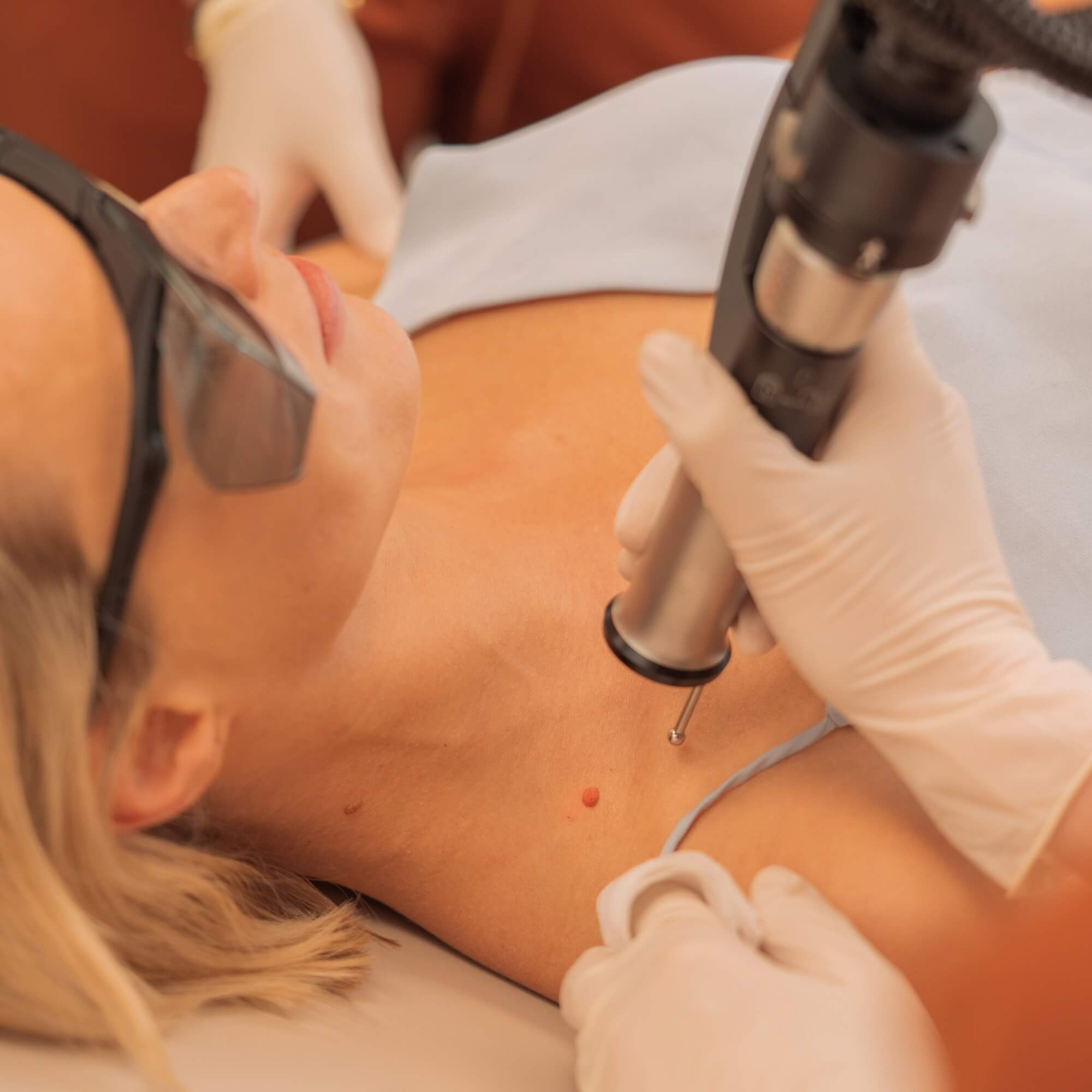 Frau mit Schutzbrille liegt entspannt, während eine Person mit Handschuhen einen Laser auf einen Hautpunkt am Hals richtet