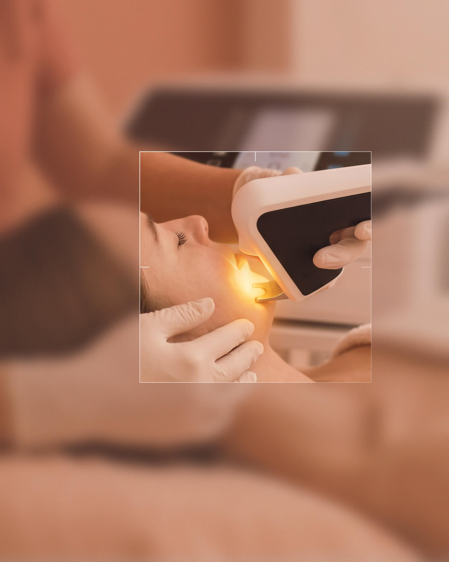 Person liegt entspannt mit geschlossenen Augen und wird im Gesicht mit einem handgehaltenen Quadrostar pro yellow Gerät behandelt