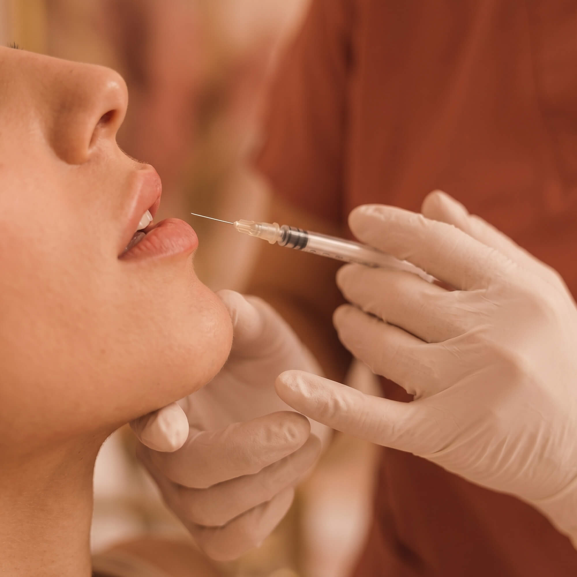 Nahaufnahme einer Person, die eine Lippenunterspritzung mit einer Spritze erhält, Hände mit weißen Handschuhen halten das Gesicht und die Spritze
