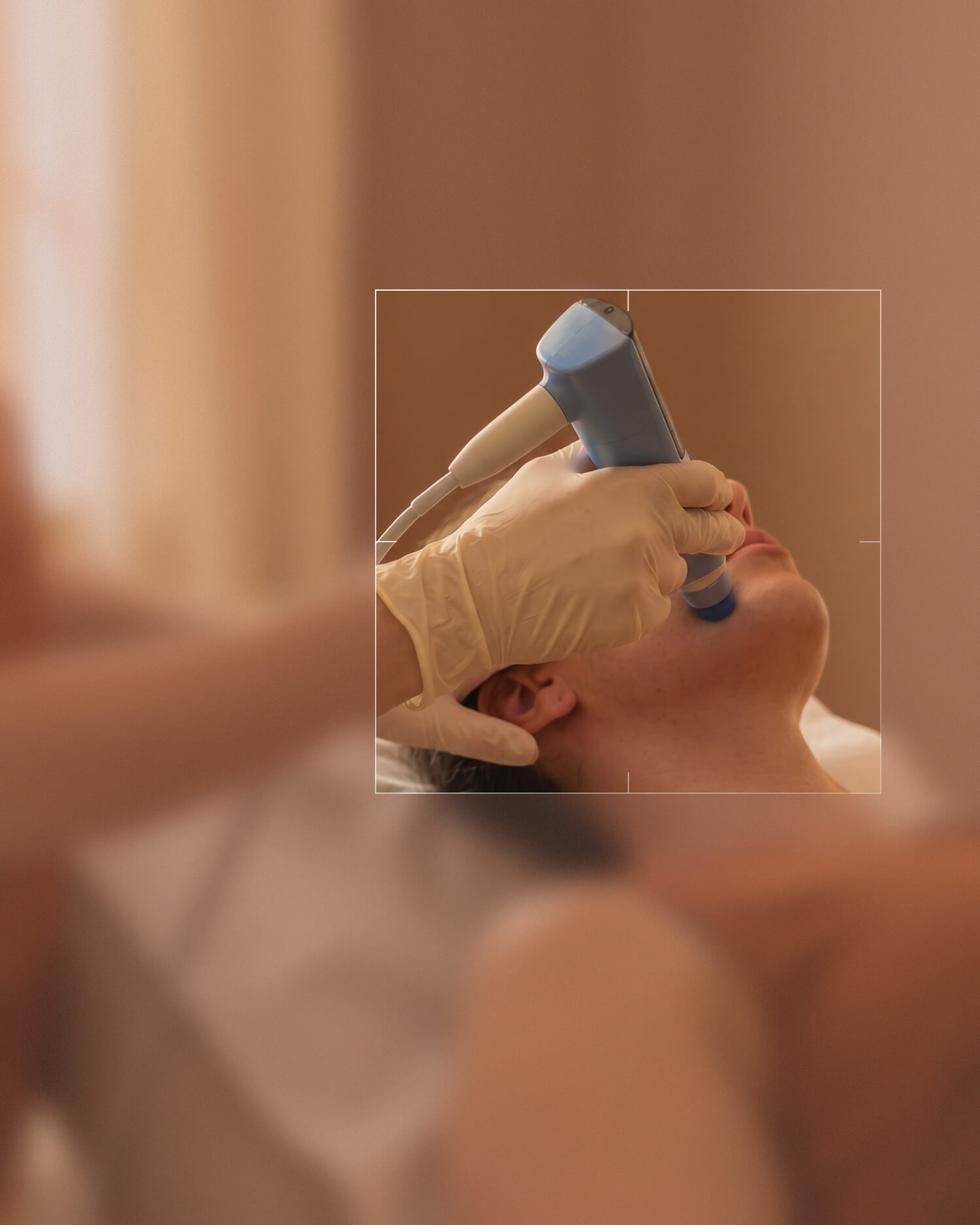 Person mit Handschuhen führt eine kosmetische Behandlung am Kinn einer liegenden Person durch