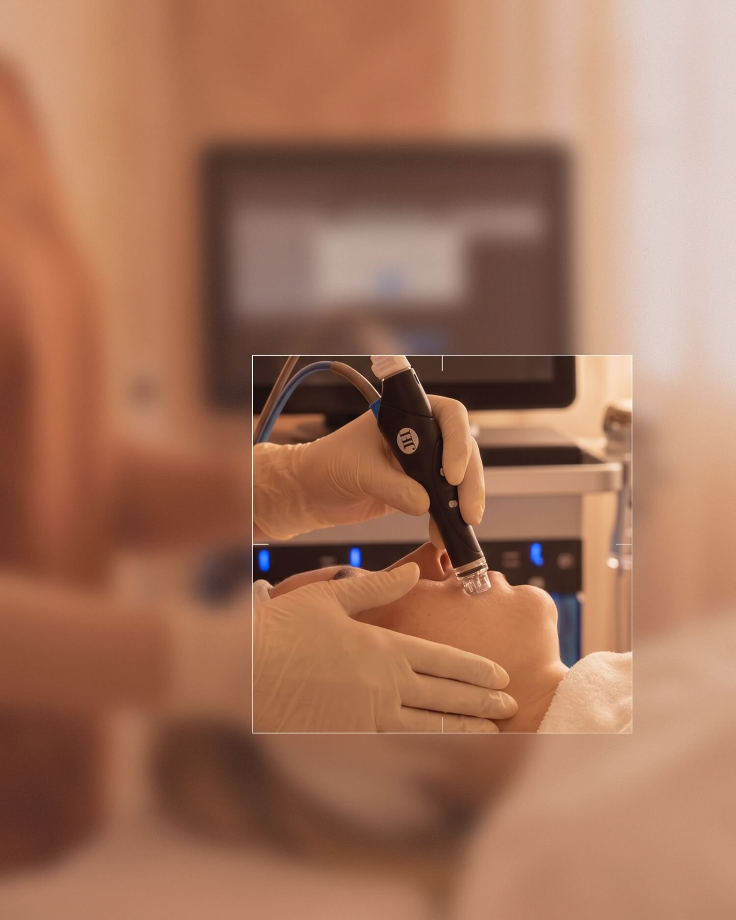 nouvada_hydrafacial_kosmetologie_desktop-1500x1500