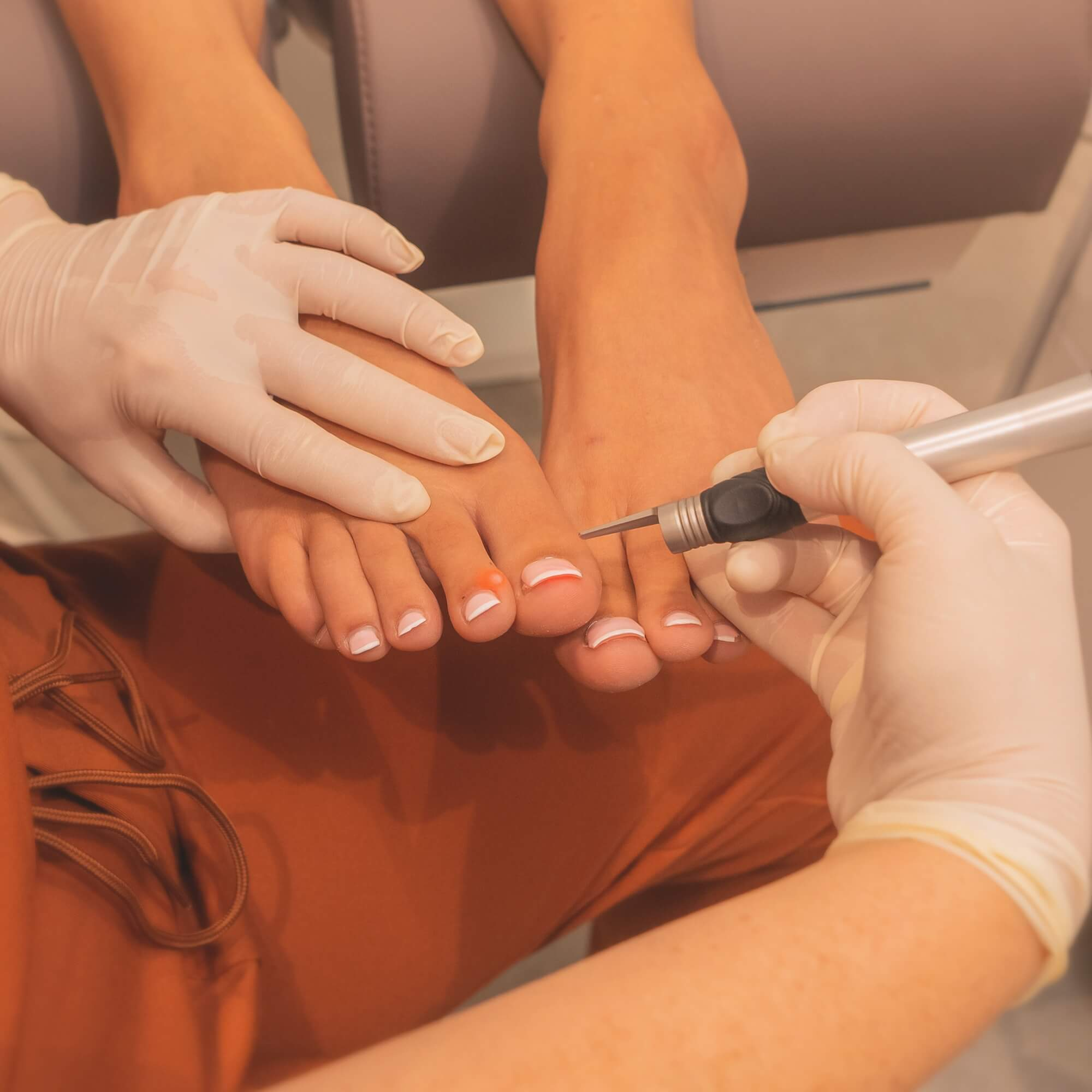 Hände mit weißen Handschuhen behandeln mit einem Lasergerät einen Fuß